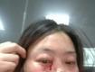 泰州一女業(yè)主被開發(fā)商圍毆到滿臉鮮血，打人者叫囂：“你甩咧！ ”